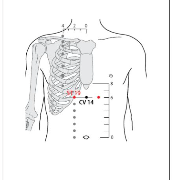 ST 19 Acupuncture Point