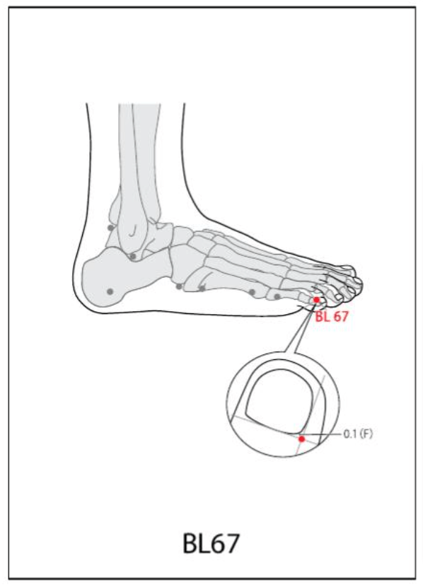 BL 67 Acupuncture Point