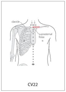 CV 22 Acupuncture Point - Acupuncture Point Locations Review