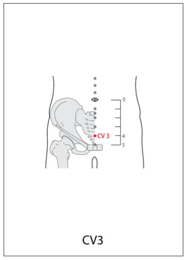 CV 3 Acupuncture Point