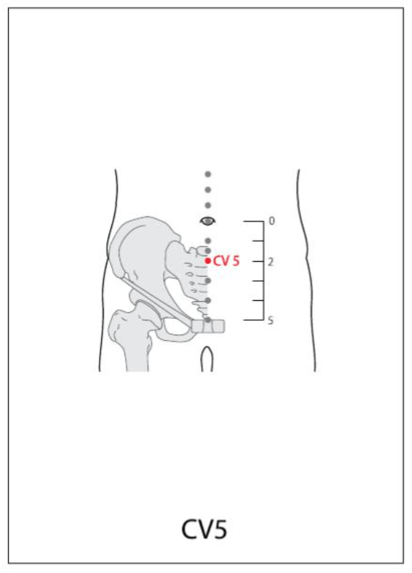 CV 5 Acupuncture Point